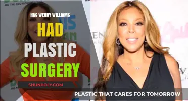 Wendy Williams Plastic Surgery: Unveiling the Truth Behind Her Transformation