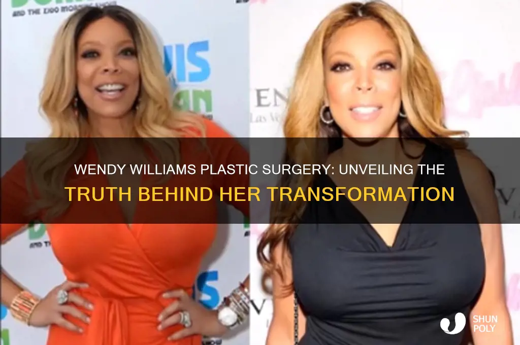 has wendy williams had plastic surgery