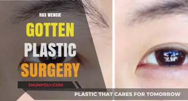 Has Wengie Had Plastic Surgery? Uncovering the Truth Behind Her Look