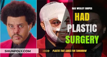 Wesley Snipes Plastic Surgery: Fact or Fiction? Uncovering the Truth