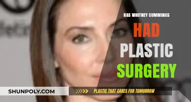 Whitney Cummings Plastic Surgery: Fact-Checking the Rumors and Speculations