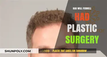 Will Ferrell's Changing Looks: Plastic Surgery Rumors Explored