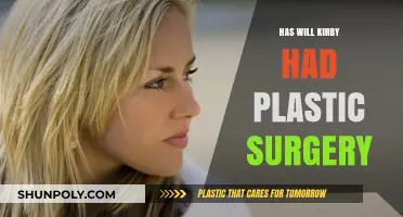 Will Kirby Plastic Surgery: Fact-Checking the Rumors and Speculations