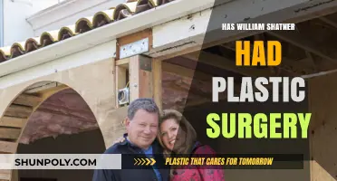 William Shatner's Transformation: Plastic Surgery Speculations and Truths