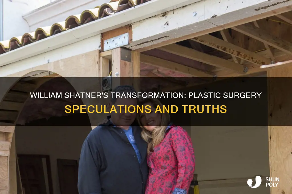 has william shatner had plastic surgery