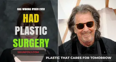 Winona Ryder's Transformation: Plastic Surgery Speculations and Truths