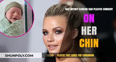 Has Witney Carson Had Plastic Surgery on Her Chin?