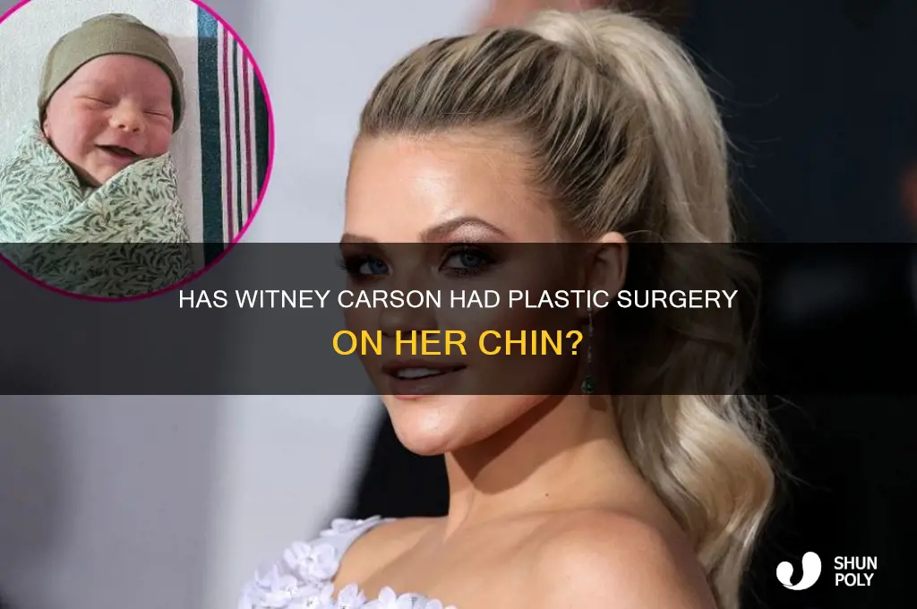 has witney carson had plastic surgery on her chin