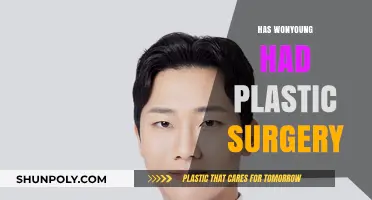 Has Wonyoung Had Plastic Surgery? Unveiling the Truth Behind Her Beauty