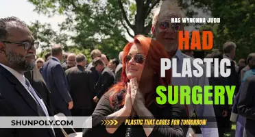 Wynonna Judd's Transformation: Plastic Surgery Rumors Explored and Debunked