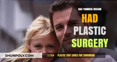 Yannick Bisson Plastic Surgery: Fact-Checking the Rumors and Speculations