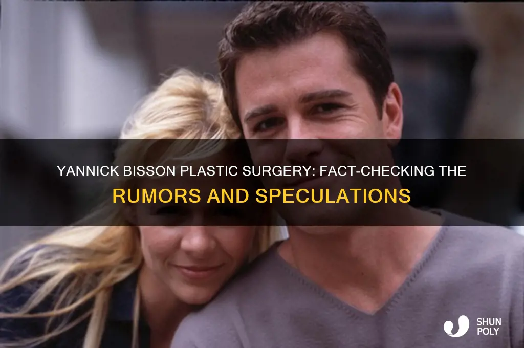 has yannick bisson had plastic surgery