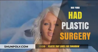 Has Yara Undergone Plastic Surgery? Unveiling the Truth Behind Her Look