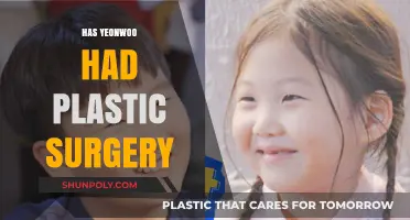 Has Yeonwoo Had Plastic Surgery? Unveiling the Truth Behind Her Transformation