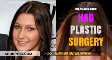 Yolanda Hadid's Transformation: Plastic Surgery Rumors and Reality Revealed