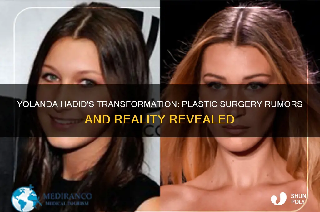 has yolanda hadid had plastic surgery