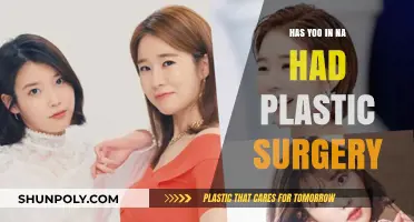 Yoo In Na Plastic Surgery: Fact or Fiction? Unveiling the Truth