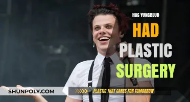 Has Yungblud Had Plastic Surgery? Unraveling the Truth Behind the Rumors