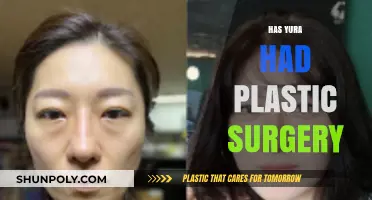 Has Yura Had Plastic Surgery? Uncovering the Truth Behind Her Look