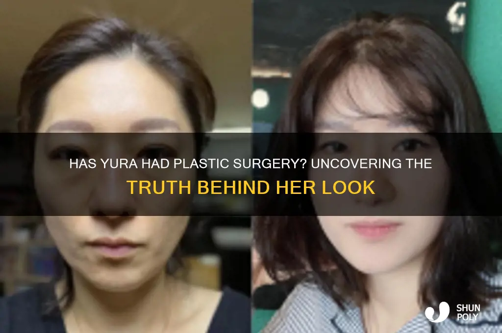 has yura had plastic surgery
