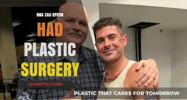 Zac Efron's Transformation: Plastic Surgery Rumors Explored and Debunked