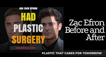 Zach Efron's Transformation: Plastic Surgery Rumors Explored and Debunked