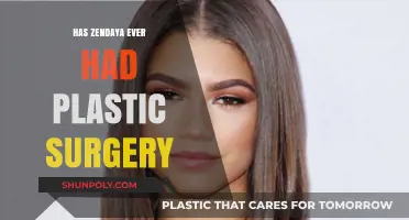 Zendaya's Natural Beauty: Debunking Plastic Surgery Rumors and Speculations
