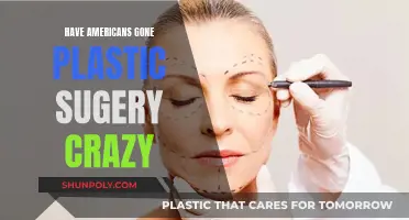 Plastic Surgery: America's Obsession or Necessity?