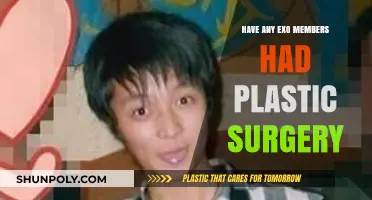 Unveiling the Truth: EXO Members and Plastic Surgery Speculations