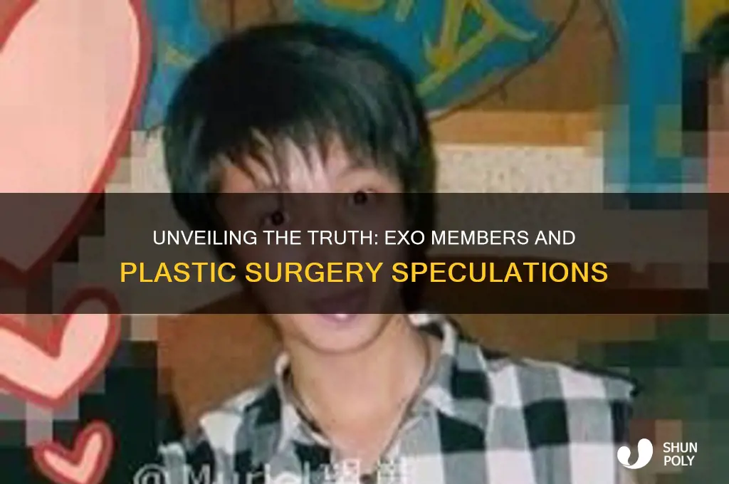have any exo members had plastic surgery