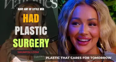 Little Mix Plastic Surgery Speculations: Truth Behind the Rumors