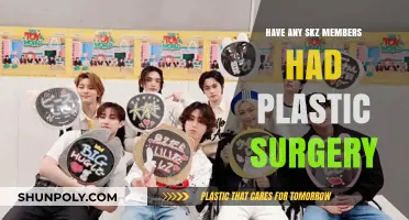Stray Kids Plastic Surgery: Uncovering the Truth About SKZ Members