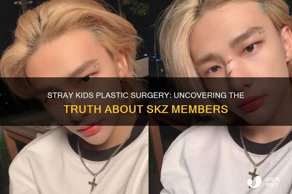 have any skz members had plastic surgery