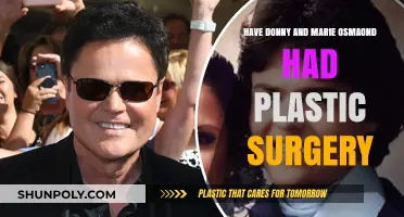 Donny and Marie Osmond's Transformation: Plastic Surgery Speculations Explored