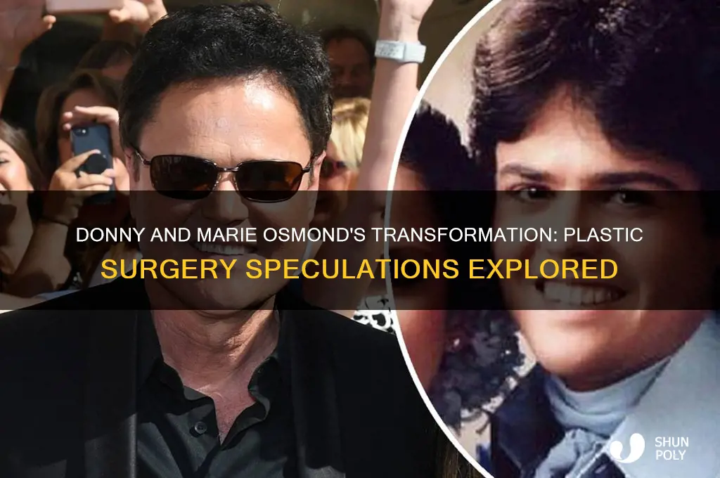 have donny and marie osmaond had plastic surgery