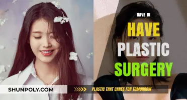 IU's Transformation: Unveiling the Truth About Plastic Surgery Rumors