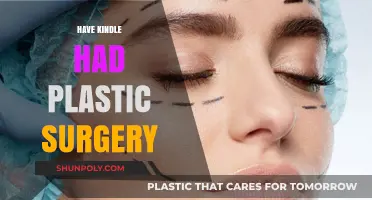 Has Kindle Undergone Plastic Surgery? Unraveling the Rumors and Facts