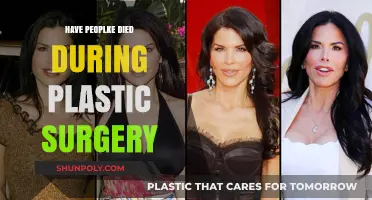 Plastic Surgery Fatalities: Uncovering the Risks and Realities
