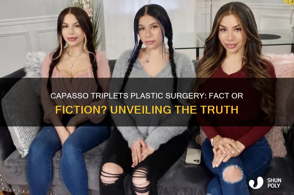 have the capasso triplets had plastic surgery