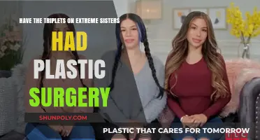 Extreme Sisters Triplets: Plastic Surgery Speculations and Transformation Truths