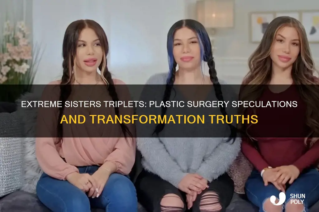 have the triplets on extreme sisters had plastic surgery