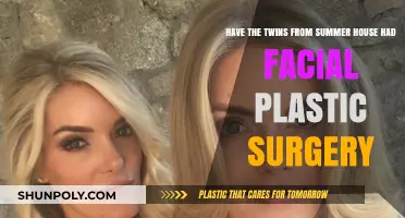 Summer House Twins' Facial Transformation: Plastic Surgery Speculation
