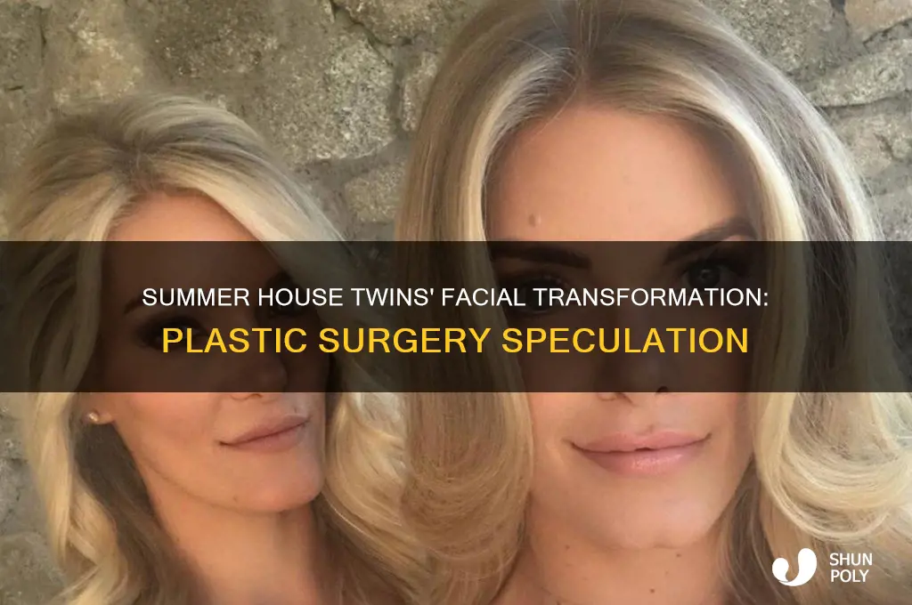 have the twins from summer house had facial plastic surgery
