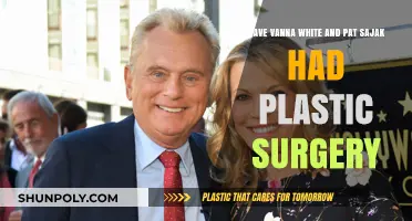 Vanna White and Pat Sajak: Plastic Surgery Speculations Explored