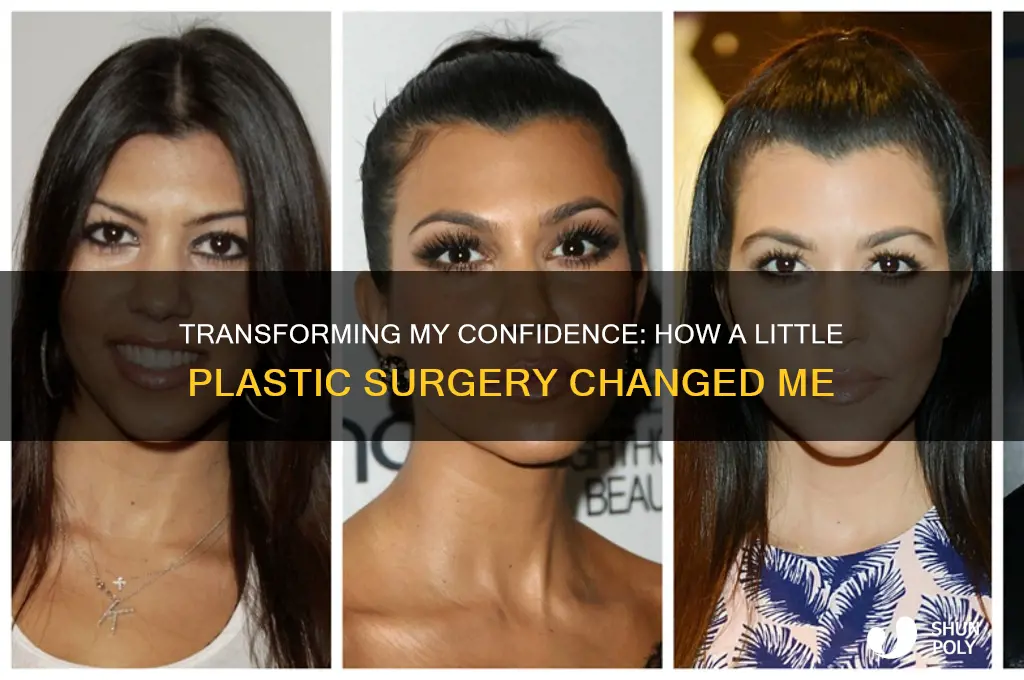 how a little plastic surgery changed me