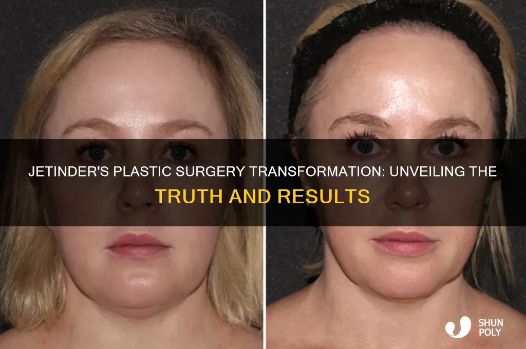 how about jetinder plastic surgery