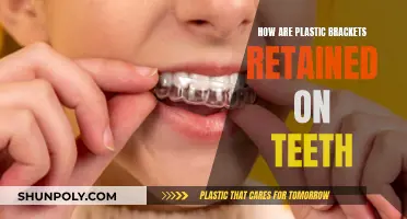 Plastic Brackets: How Do They Stay on Teeth?
