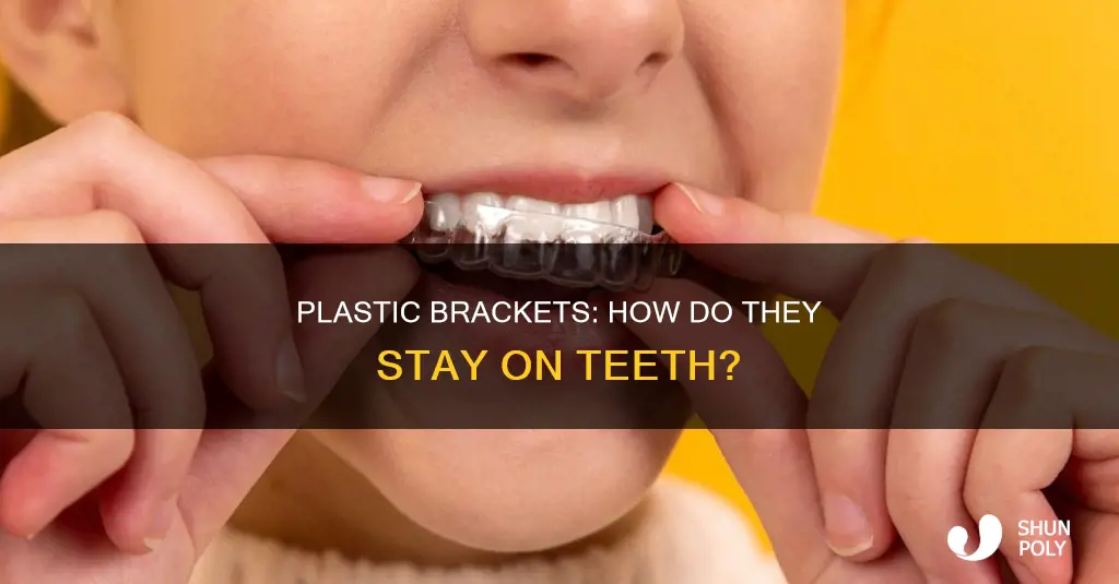 how are plastic brackets retained on teeth
