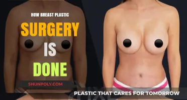 Understanding Breast Plastic Surgery: Techniques, Procedures, and Recovery Explained
