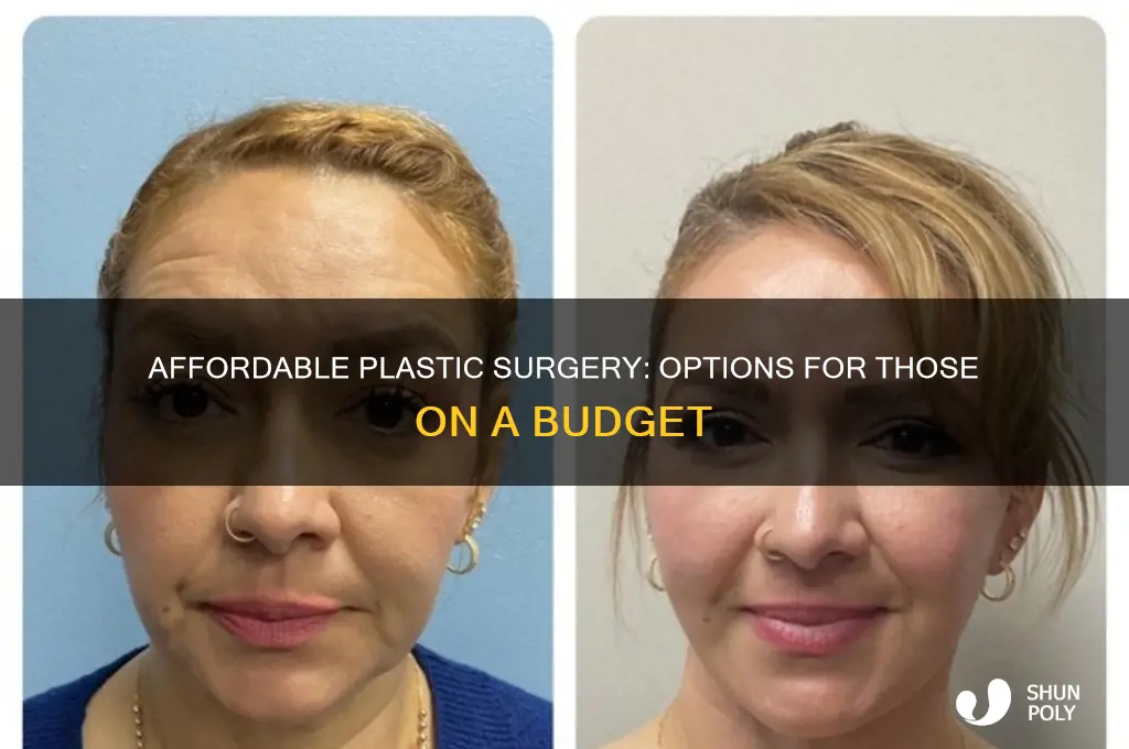 how can an ugly person afford plastic surgery
